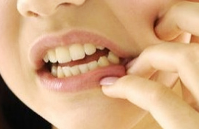 突發(fā)性、自發(fā)性的劇烈牙疼