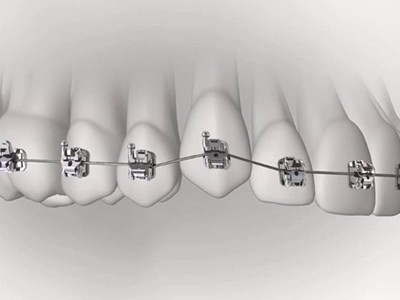 承德市哪家口腔醫(yī)院口腔正畸做得好？惟德口腔醫(yī)院來告訴您