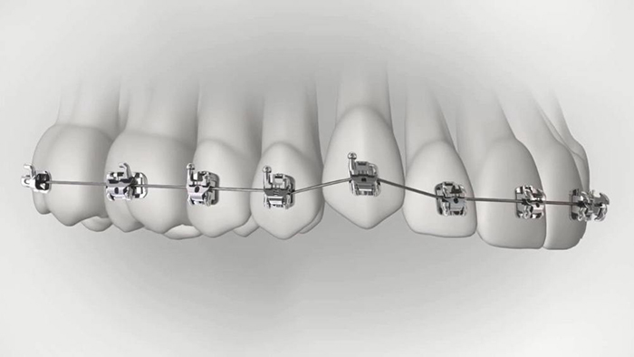 承德市哪家口腔醫(yī)院口腔正畸做得好？惟德口腔醫(yī)院來(lái)告訴您
