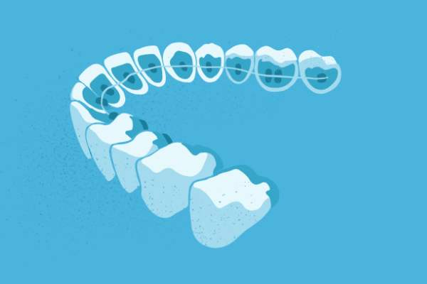 惟德口腔醫(yī)院口腔正畸好不好？